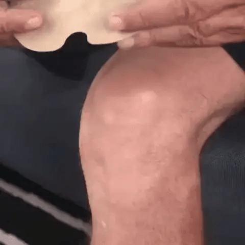 ADHESIVOS TERAPÉUTICOS PARA EL ALIVIO DE RODILLAS Y ARTICULACIONES - PROKNEE™ (OFERTA REGALO)