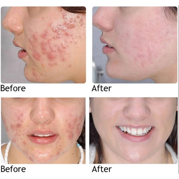 MÁSCARILLA EN BARRA ENRIQUECIDA CON TÉ VERDE - CRYSTAL SKIN™- COMPRA 1 LLÉVATE 2